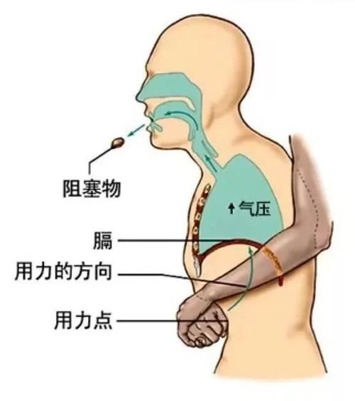 这种恶性肿瘤早期容易被忽视！别慌，有预防手段丨健康总动员